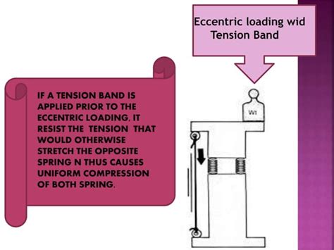 Principle of tension band wiring n its application