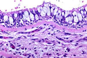 Pseudostratified Columnar Epithelium | Histology, Anatomy & Types