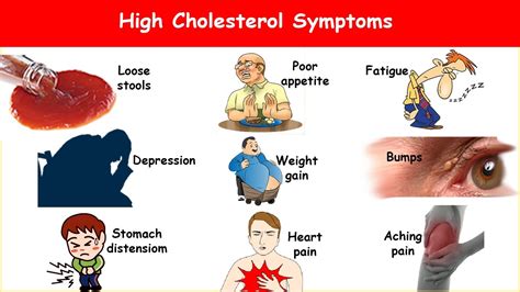 9 High Cholesterol Symptoms! What are High Cholesterol Signs & Symptoms? - YouTube