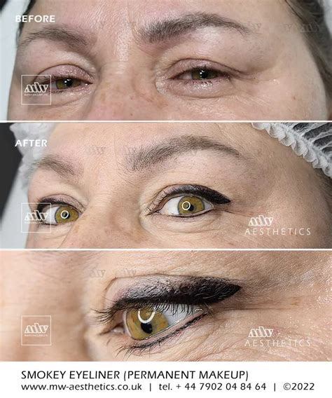 Semi Permanent Eyeliner Before And After – vttluberon