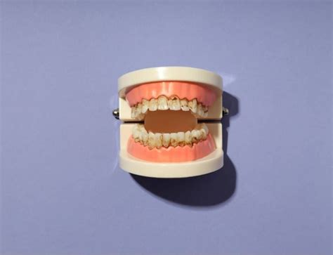 Reasons Bottom Dentures Won’t Stay in and How to Fix Them | Dentures, Denture adhesives, Denture ...