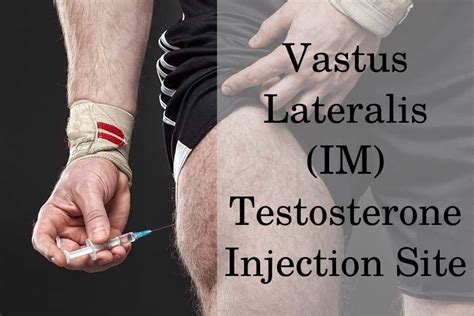 Testosterone IM Injection Sites