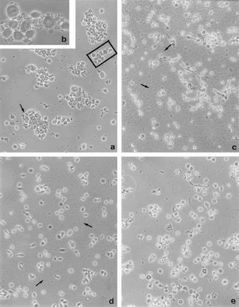 Light microscopy (magnification, ϫ 100) of agglutination of G ...