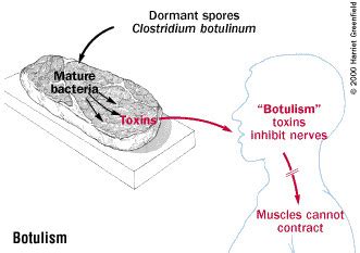 Botulism - Russia Six Botulism Deaths In Volgograd In First Half Of ...