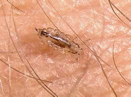 Body lice