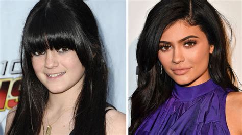 Kylie Jenner Before And After - Check Out The Youngest Kardashian ...