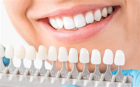 How Do I Take Care of My Dental Implants? - VDSC