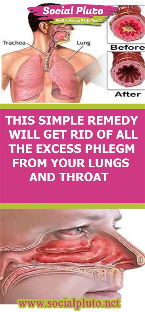 THIS SIMPLE REMEDY WILL GET RID OF ALL THE EXCESS PHLEGM FROM YOUR LUNGS AND THROAT | Lunges ...