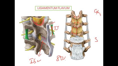 Ligamentum Flavum