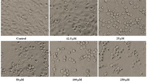 Morphological changes in HepG2 cells exposed to various concentrations ...