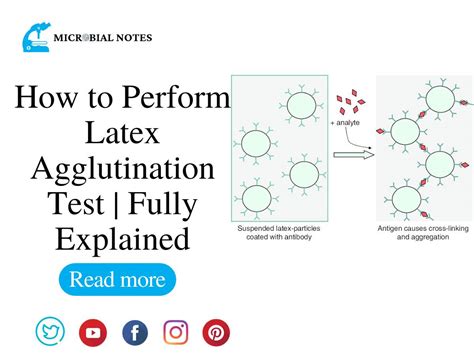 How to Perform Latex Agglutination Test | Fully Explained