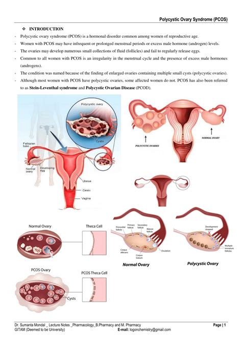 (PDF) Polycystic Ovary Syndrome (PCOS)