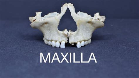 MAXILLA - YouTube