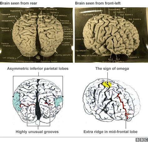 The strange afterlife of Einstein's brain - BBC News