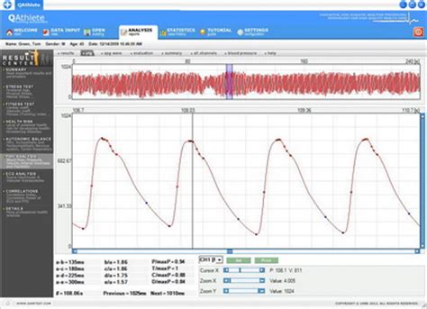 Pulse Wave Velocity Analysis - QLine