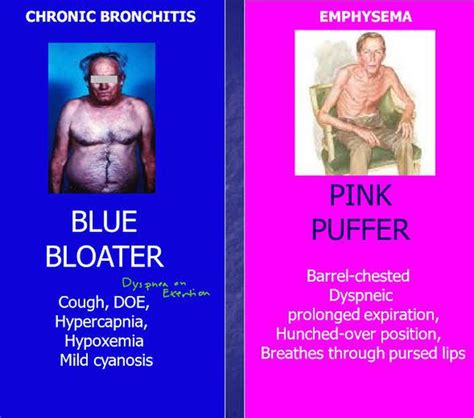 BLUE BLOATER vs PINK PUFFER - MEDizzy