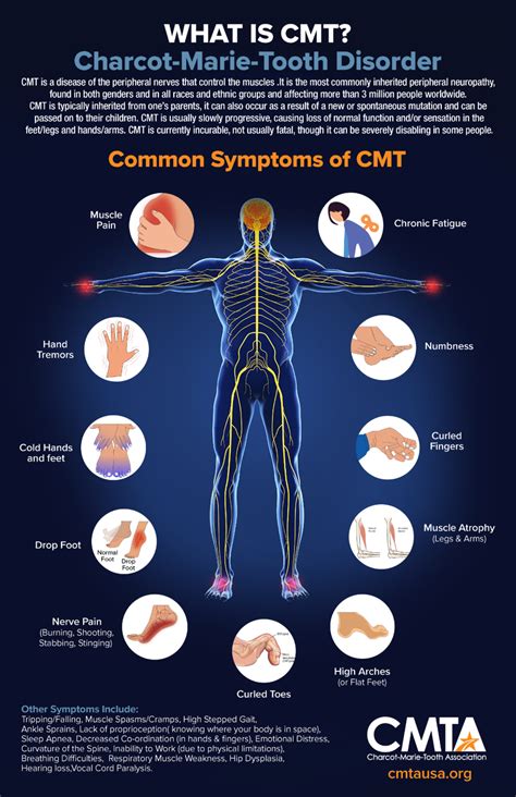 Marie Tooth Disease: Charcot Marie Tooth Treatment | ubicaciondepersonas.cdmx.gob.mx