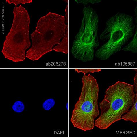 Alexa Fluor® 647 Anti-Actin antibody [EPR16769] (ab206278) | Abcam