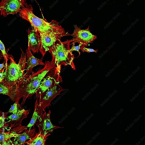 Microscopy imaging of metastatic cancer cells Stock Illustration ...