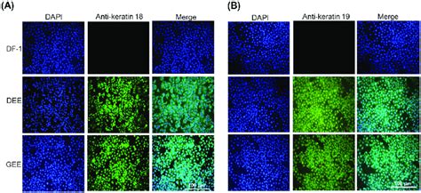 Expression of epithelial cell markers (keratin-18 and-19) in the ...