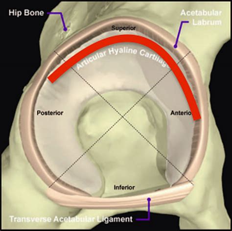 Hip Injuries | labrum tears | repairing labral tears