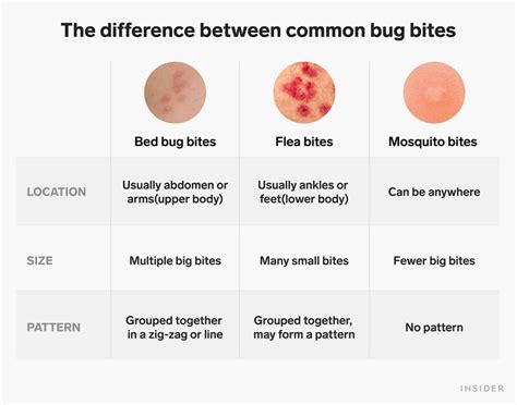 What is biting my toddler in bed? : r/CasualIreland