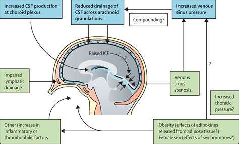 Understanding idiopathic intracranial hypertension: mechanisms ...