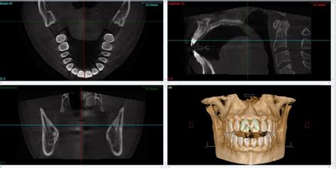 3D Dental Imaging - Allgemeine Zahnheilkunde - 212 Lächeln | Savage Rose