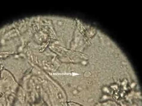 Trichomonas vaginalis on 40x microscope - YouTube