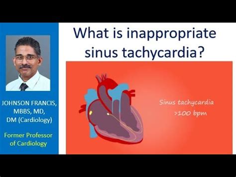 What is inappropriate sinus tachycardia? - YouTube