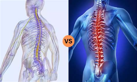 Difference Between Neurogenic Shock and Spinal Shock