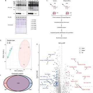 Proteome‐wide identification of lysine acetylation proteins and sites... | Download Scientific ...