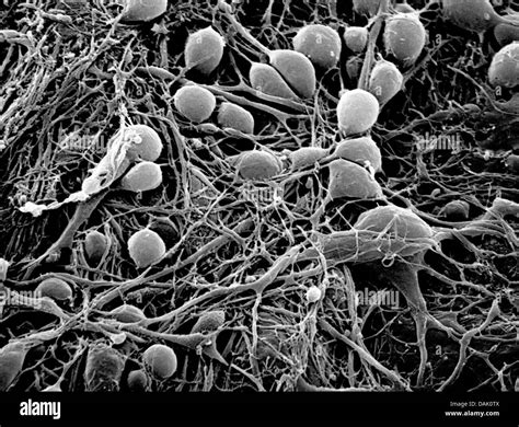 Nerve Cell Electron Microscope