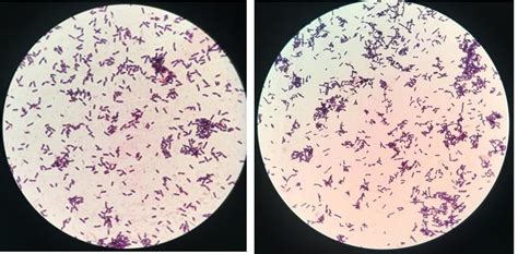 Lactobacillus Gram Stain
