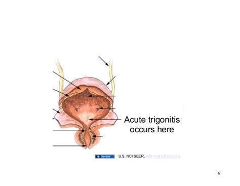 GEMC: Urinary Tract Infections: Resident Training