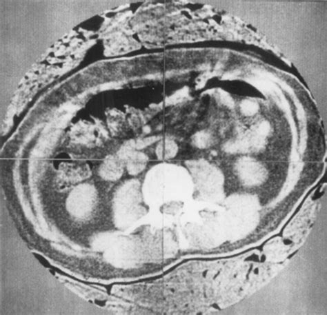 History of Medical Imaging timeline | Timetoast timelines