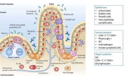 Inflammation of the intestinal mucosa caused by H. pylori