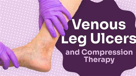 Venous Leg Ulcers and Compression Therapy | Ausmed Articles