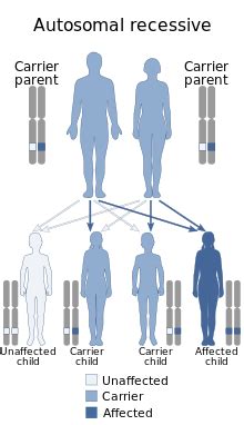 Niemann–Pick disease - Wikipedia