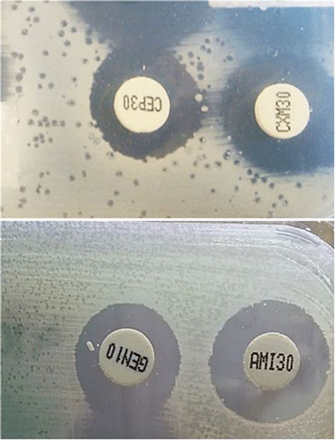 Phages on antibiogram plates.: Two examples of antibiogram agar plates... | Download Scientific ...