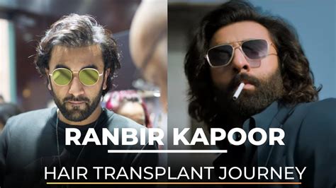 Ranbir Kapoor’s Hair Transplant Journey | Dr Nivedita dadu - YouTube