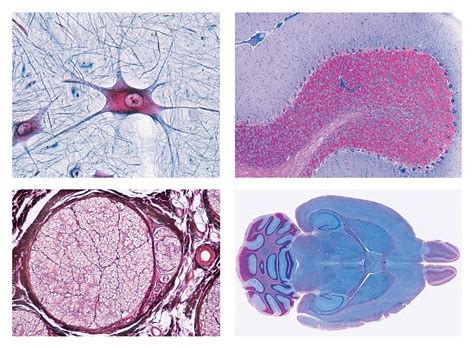 Histology and Human Science, Detail Set, Nervous System, 11 microscope slides incl. Box | PHYWE