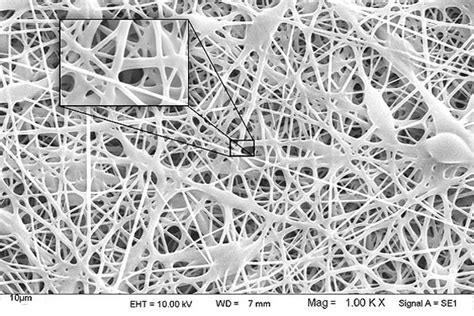 Tissue engineering scaffolds production - Histogenotech