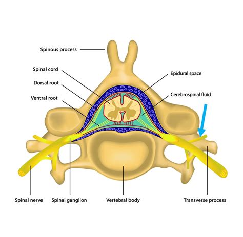 Medial branch blocks | Orthopaedie - Schmerztherapie