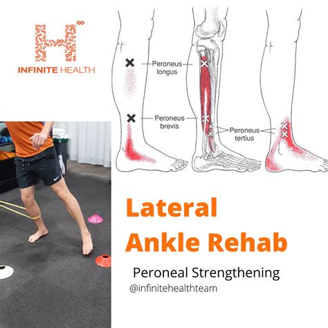Lateral Ankle Rehab - Peroneal Strengthening