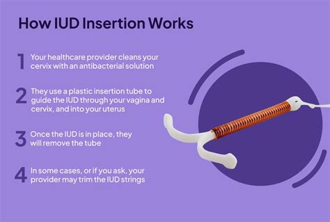 IUD Insertion: How it Works and What to Expect