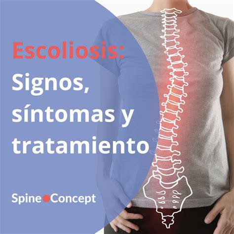 Escoliosis Lumbar