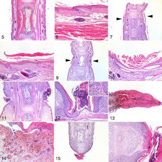 (PDF) Pathologic and Environmental Studies Provide New Pathogenetic Insights Into Ringtail of ...