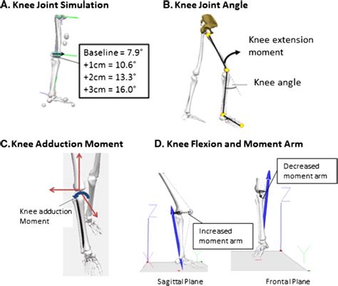 Modelling knee flexion effects on joint power absorption and adduction moment - The Knee