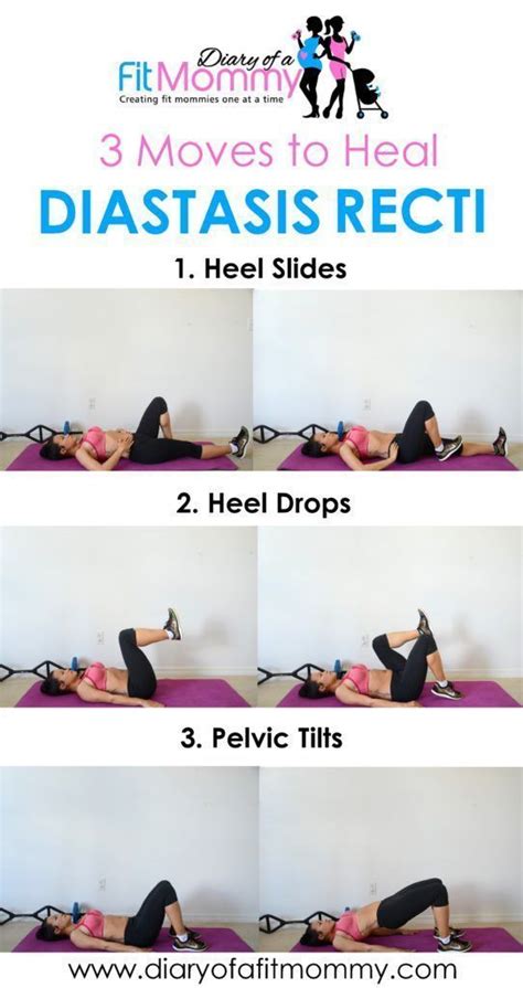 Pin on Rectus Diastasis Exercises